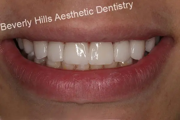 dentist in Beverly Hills CA