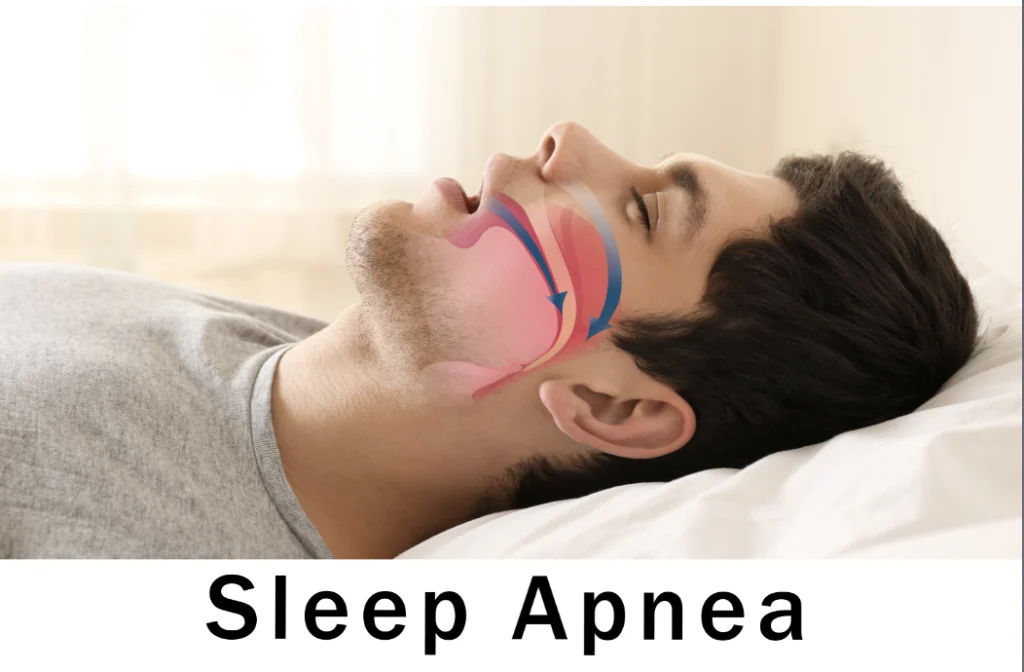 sleep apnea center