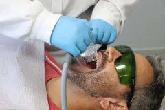 beverly hills dentist