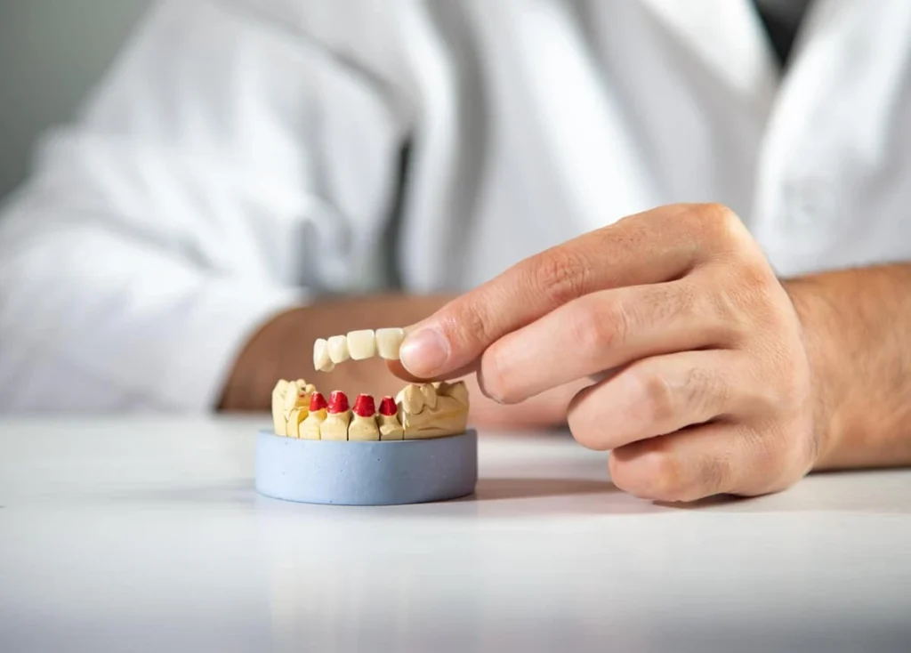 Porcelain Crowns: Natural-Looking and Durable Solutions