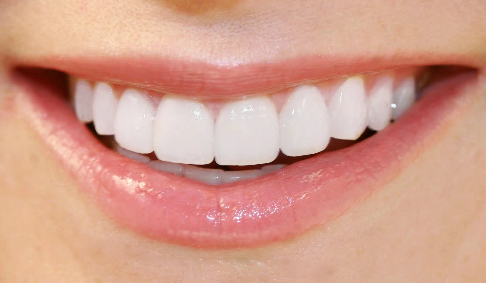 Cosmetic Teeth Veneers: Enhancing Your Smile and Dental Health