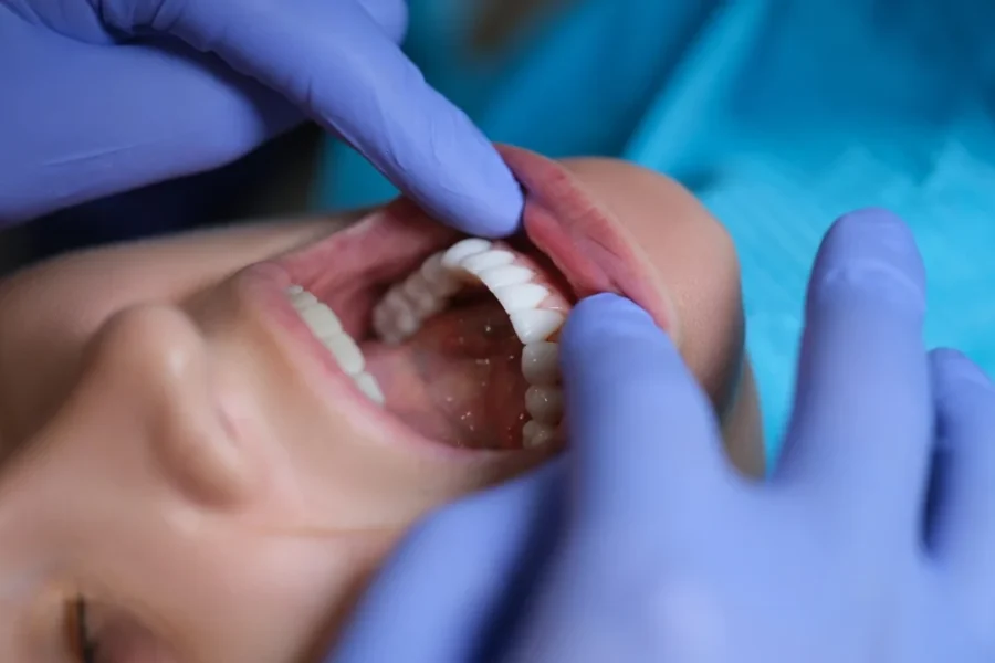 Comparing Porcelain and Composite Veneers in Beverly Hills