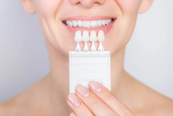 Enhancing Smiles with Composite Dental Veneers