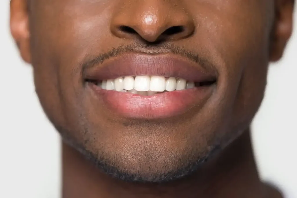 Protecting Your Enamel During Teeth Whitening