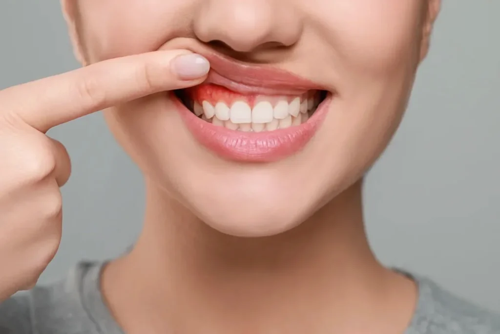 Gum Disease Prevention: Advice from Dental Professionals